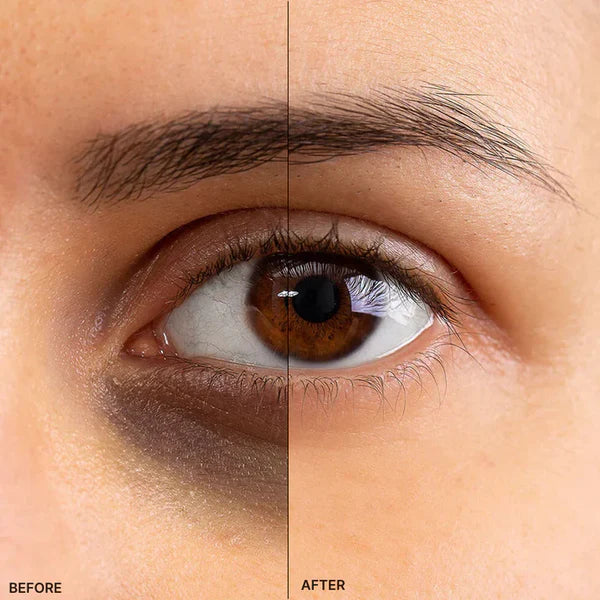 EMS Micro-Current Eye Massager