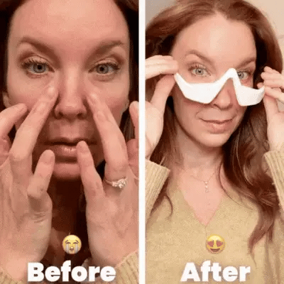 EMS Micro-Current Eye Massager